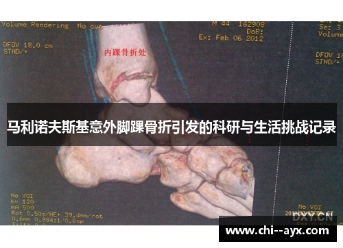 马利诺夫斯基意外脚踝骨折引发的科研与生活挑战记录